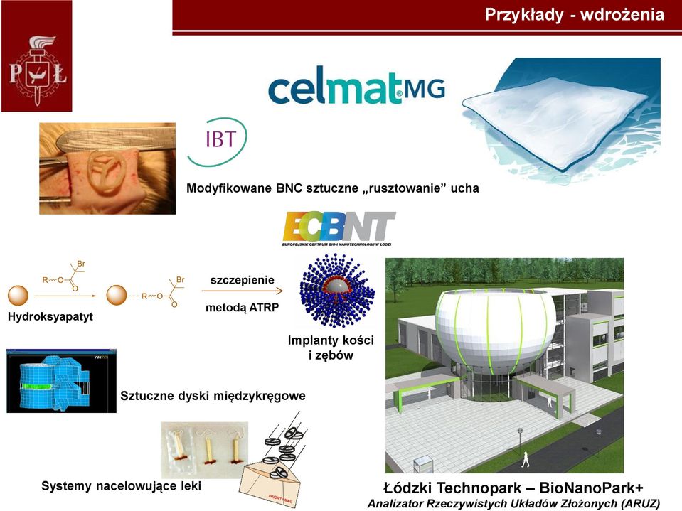 Sztuczne dyski międzykręgowe Systemy nacelowujące leki Łódzki