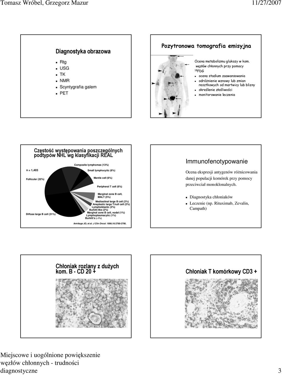 poszczególnych podtypów NHL wg klasyfikacji REAL Composite lymphomas (13%) Immunofenotypowanie n = 1,403 Follicular (22%) Small lymphocytic (6%) Mantle cell (6%) Peripheral T cell (6%) Ocena