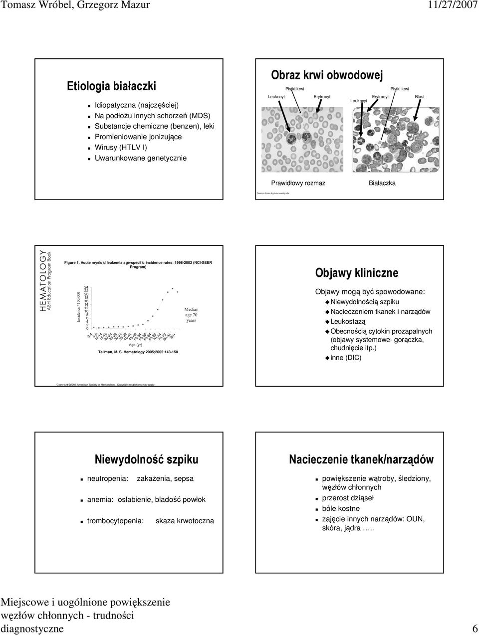 Acute myeloid leukemia age-specific incidence rates: 1998-2002 (NCI-SEER Program) Objawy kliniczne Tallman, M. S.