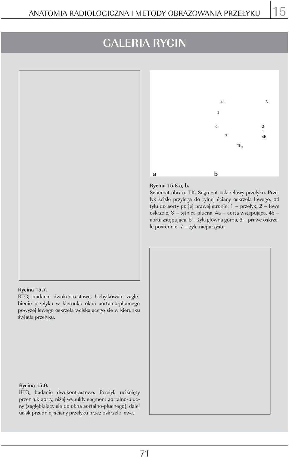 przełyk, lewe oskrzele, tętnic płucn, ort wstępując, ort zstępując, 5 żył główn górn, 6 prwe oskrzele pośrednie, 7 żył nieprzyst. Rycin 5.7. rtg, dnie dwukontrstowe.
