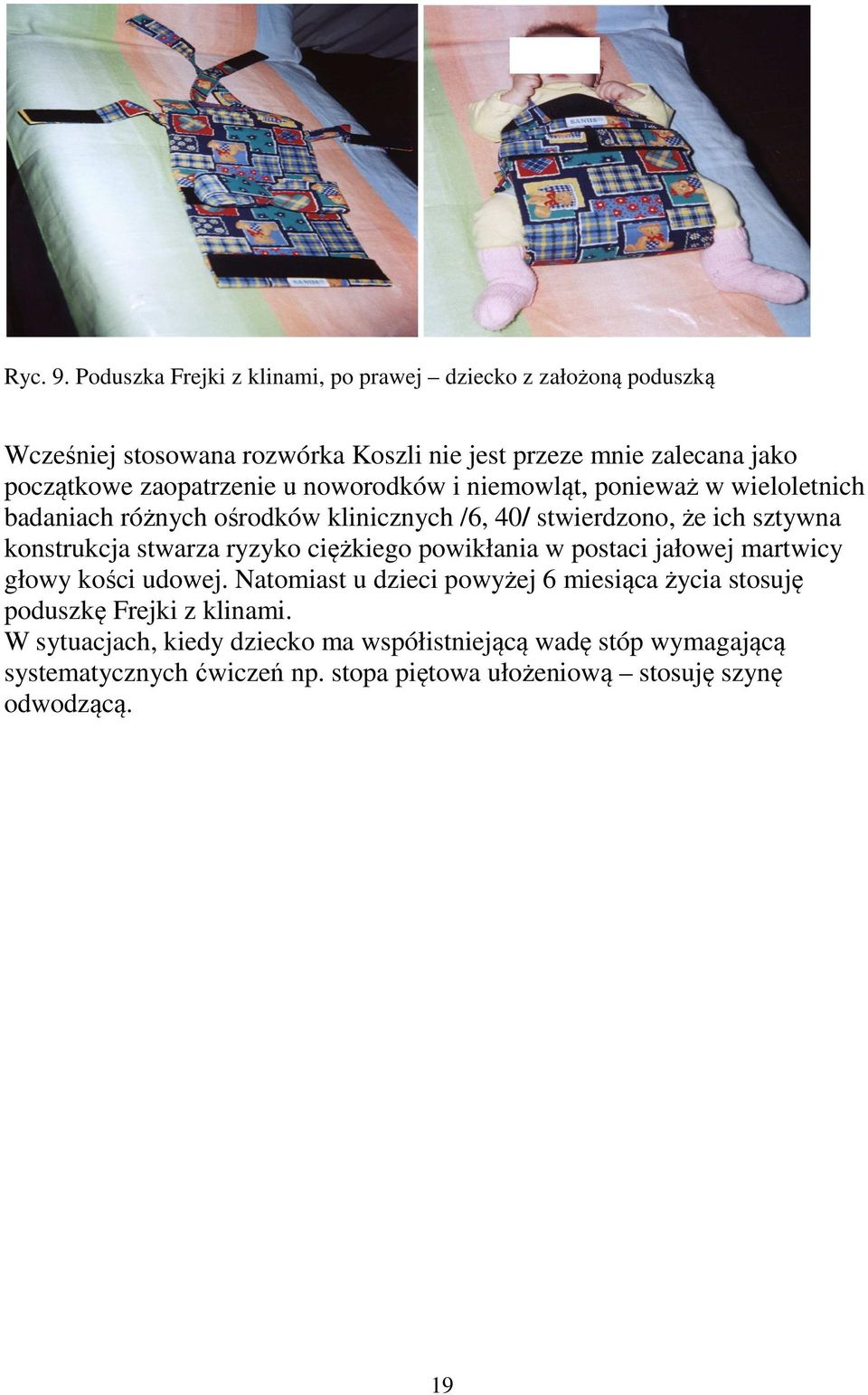 zaopatrzenie u noworodków i niemowląt, ponieważ w wieloletnich badaniach różnych ośrodków klinicznych /6, 40/ stwierdzono, że ich sztywna konstrukcja