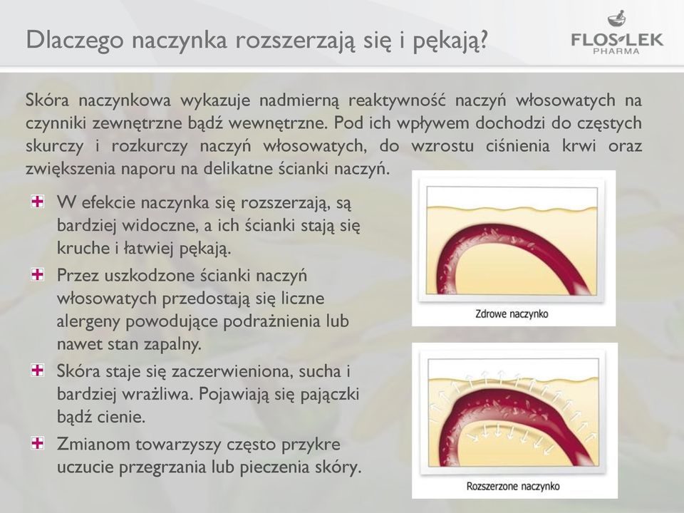 W efekcie naczynka się rozszerzają, są bardziej widoczne, a ich ścianki stają się kruche i łatwiej pękają.