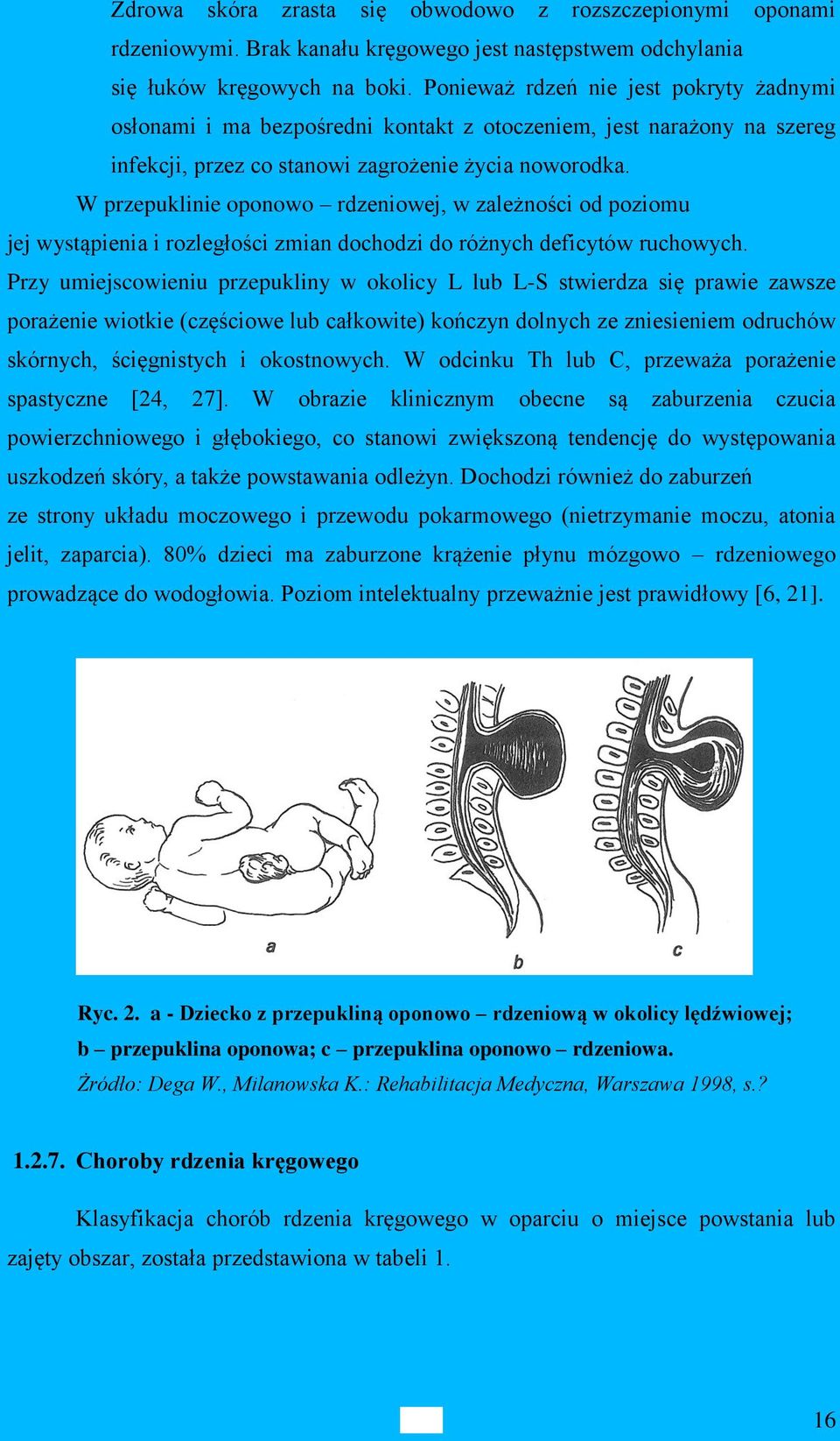 W przepuklinie oponowo rdzeniowej, w zależności od poziomu jej wystąpienia i rozległości zmian dochodzi do różnych deficytów ruchowych.