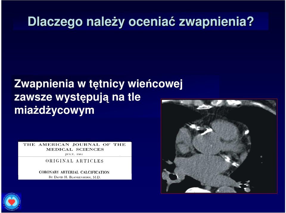 Zwapnienia w tętnicy