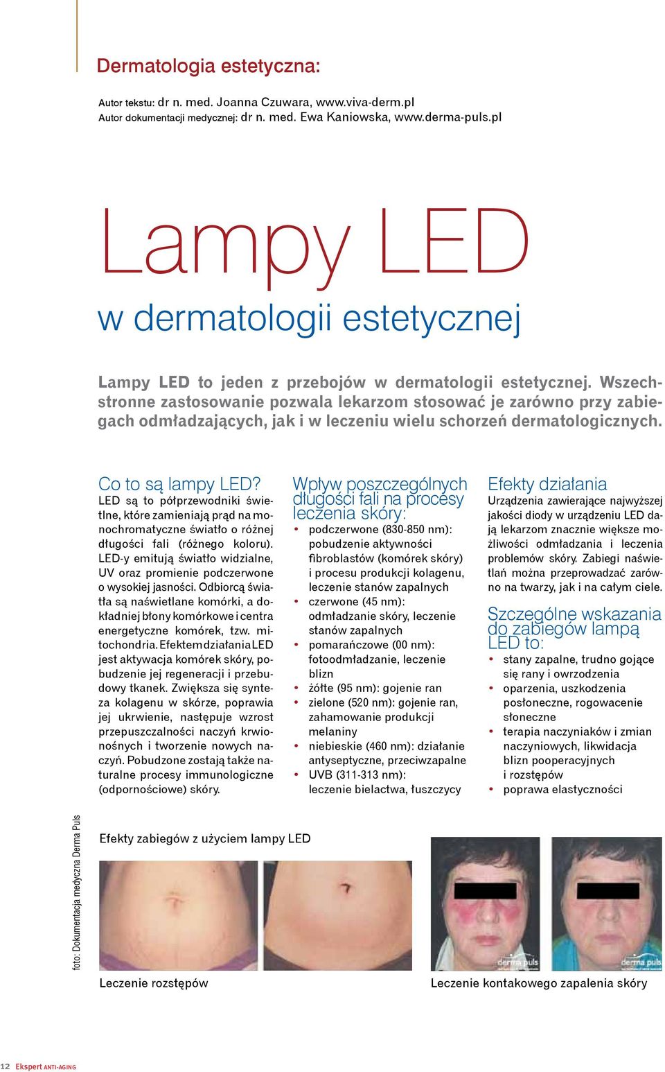 Wszechstronne zastosowanie pozwala lekarzom stosować je zarówno przy zabiegach odmładzających, jak i w leczeniu wielu schorzeń dermatologicznych. Co to są lampy LED?