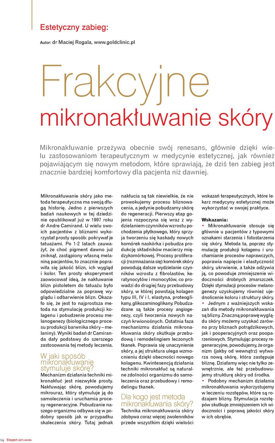 metodom, które sprawiają, że dziś ten zabieg jest znacznie bardziej komfortowy dla pacjenta niż dawniej. Mikronakłuwanie skóry jako metoda terapeutyczna ma swoją długą historię.