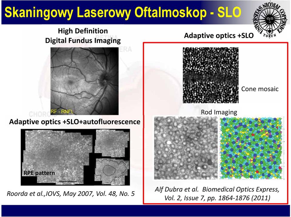 +SLO+autofluoescence Rod Imaging RPE patten Rooda et al.