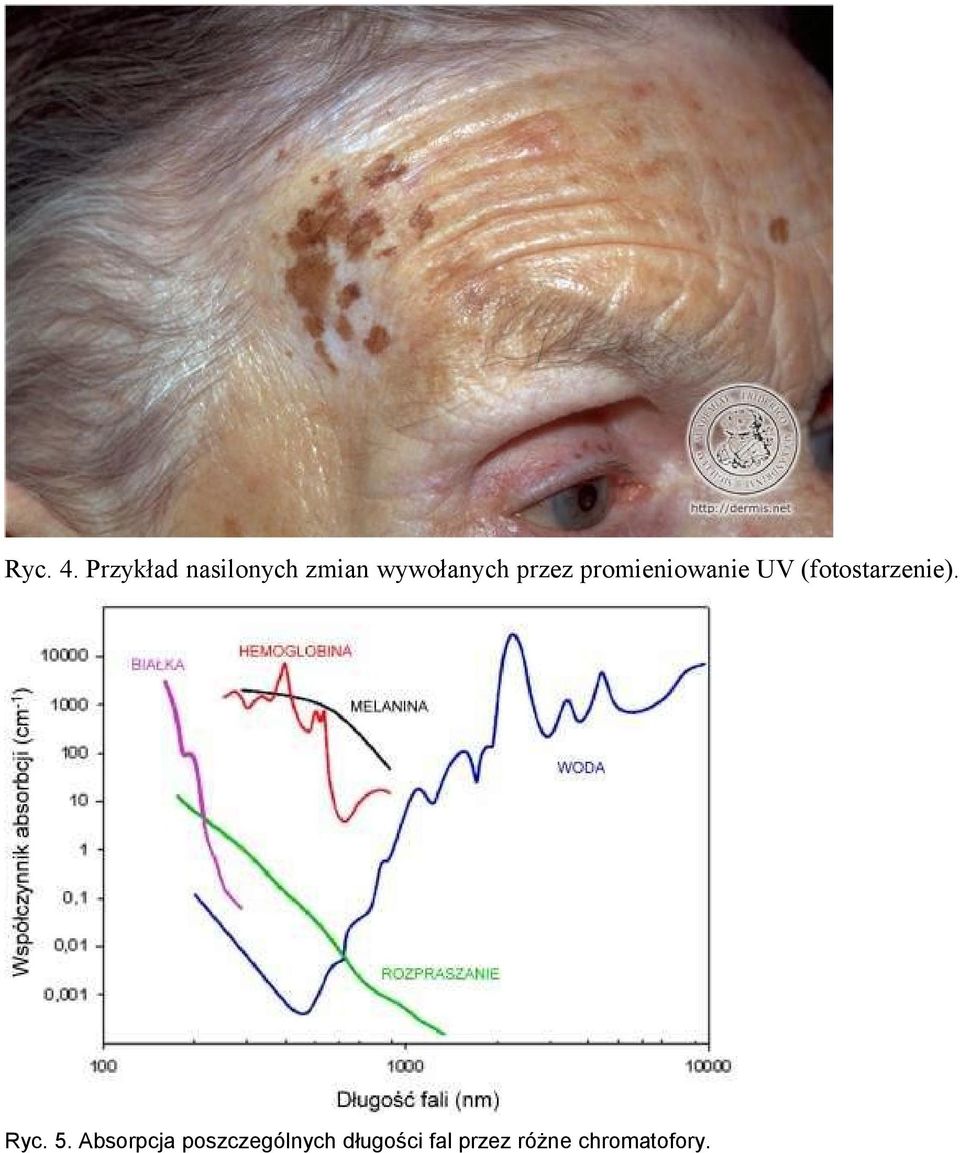 przez promieniowanie UV (fotostarzenie).