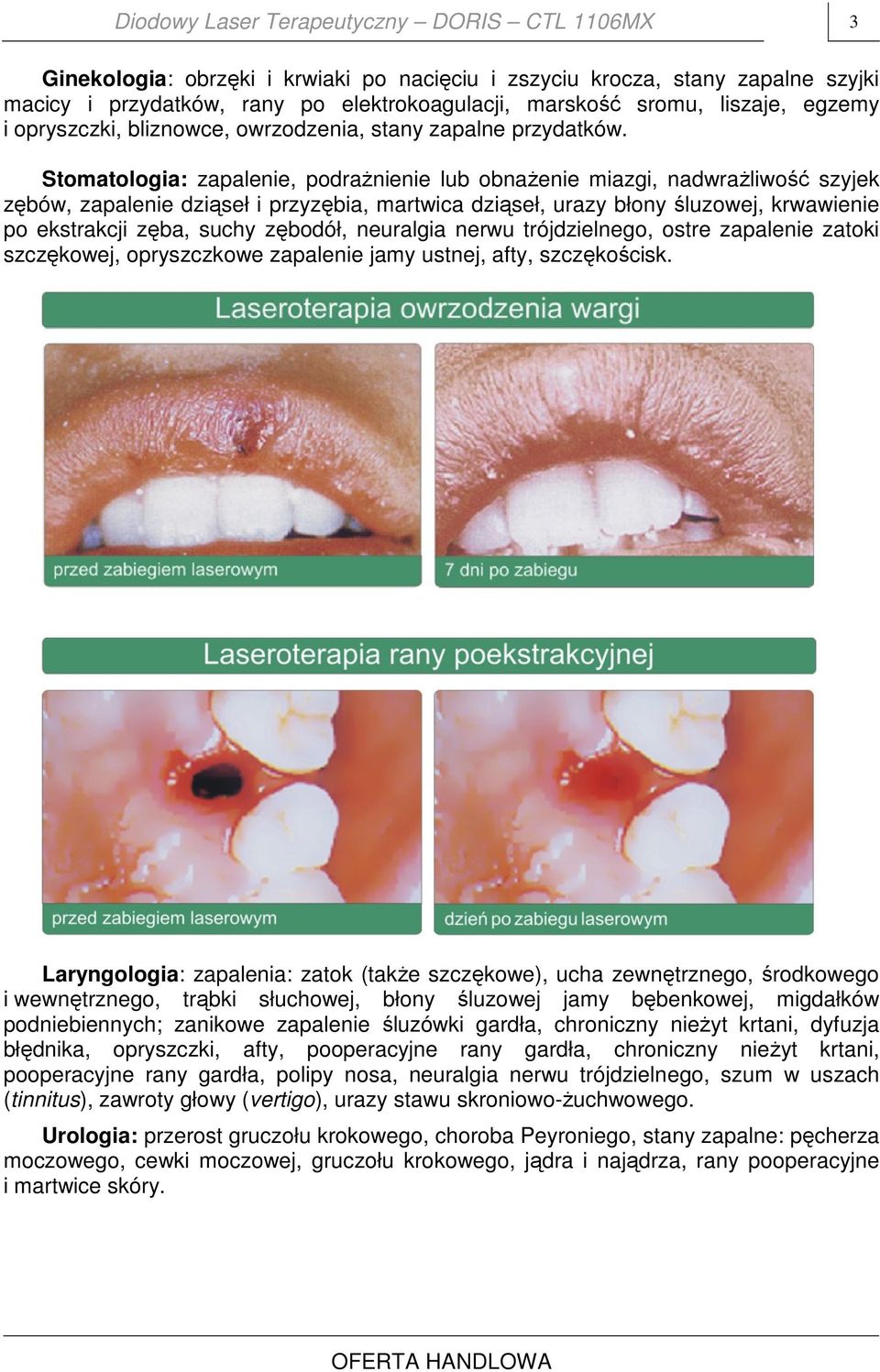 Stomatologia: zapalenie, podrażnienie lub obnażenie miazgi, nadwrażliwość szyjek zębów, zapalenie dziąseł i przyzębia, martwica dziąseł, urazy błony śluzowej, krwawienie po ekstrakcji zęba, suchy