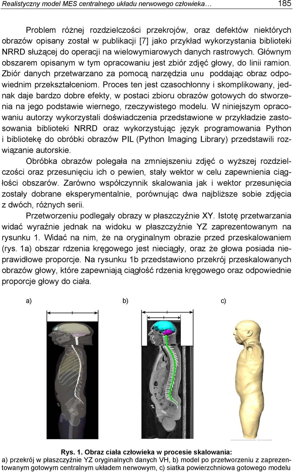 Zbiór danych przetwarzano za pomocą narzędzia unu poddając obraz odpowiednim przekształceniom.