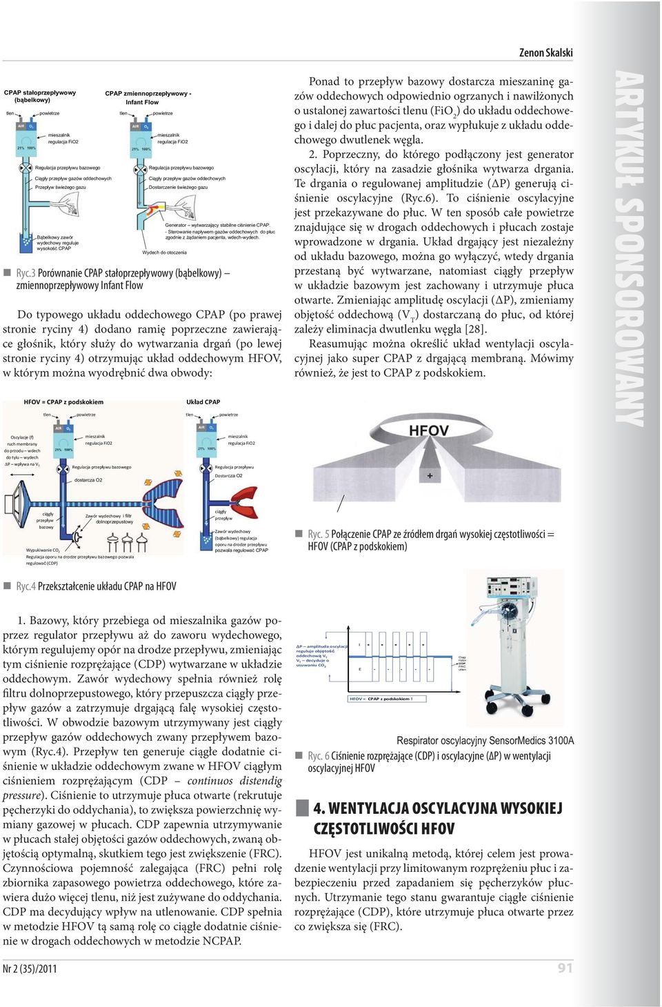 Generator wytwarzajcy stabilne cinienie CPAP. - Sterowanie napywem gazów oddechowych do puc zgodnie z daniem pacjenta, wdech-wydech. Ryc.