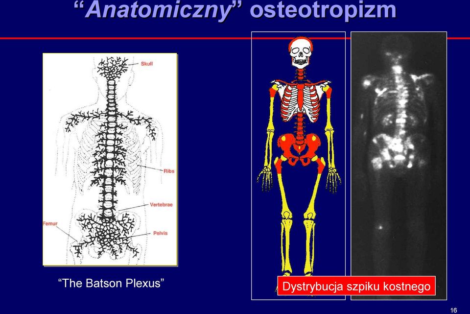 Batson Plexus