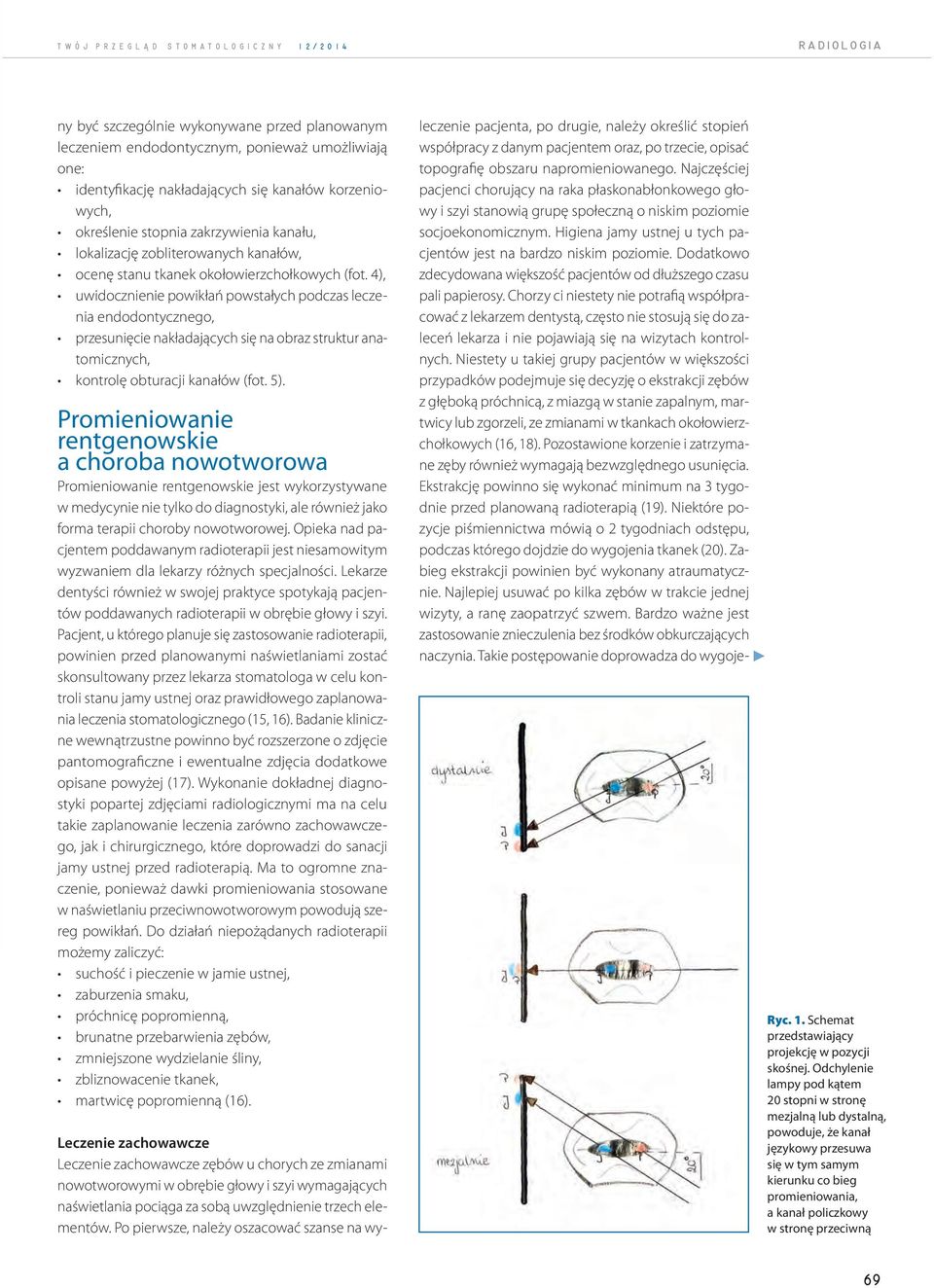 4), uwidocznienie powikłań powstałych podczas leczenia endodontycznego, przesunięcie nakładających się na obraz struktur anatomicznych, kontrolę obturacji kanałów (fot. 5).