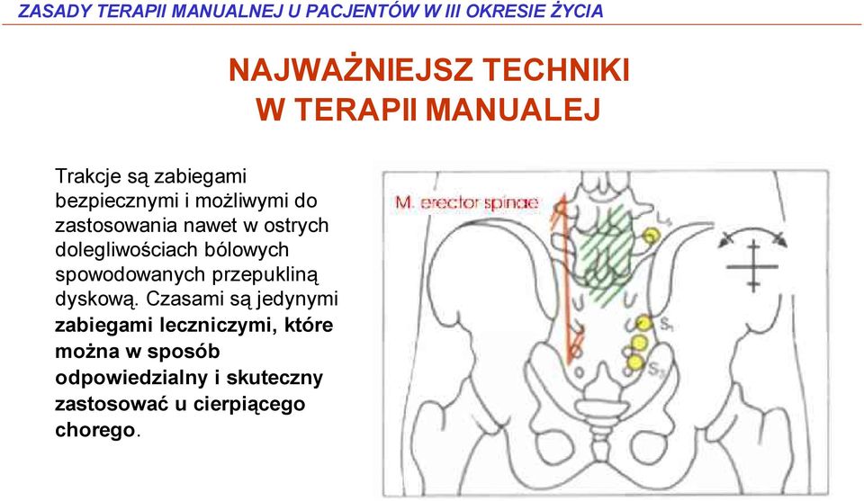 przepukliną dyskową.