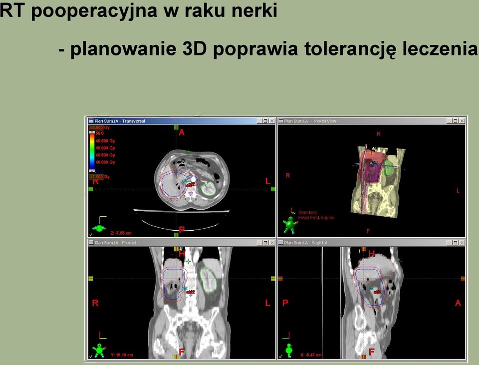 planowanie 3D