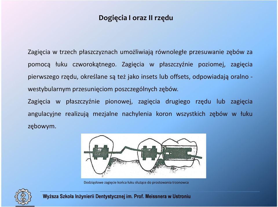 westybularnym przesunięciom poszczególnych zębów.