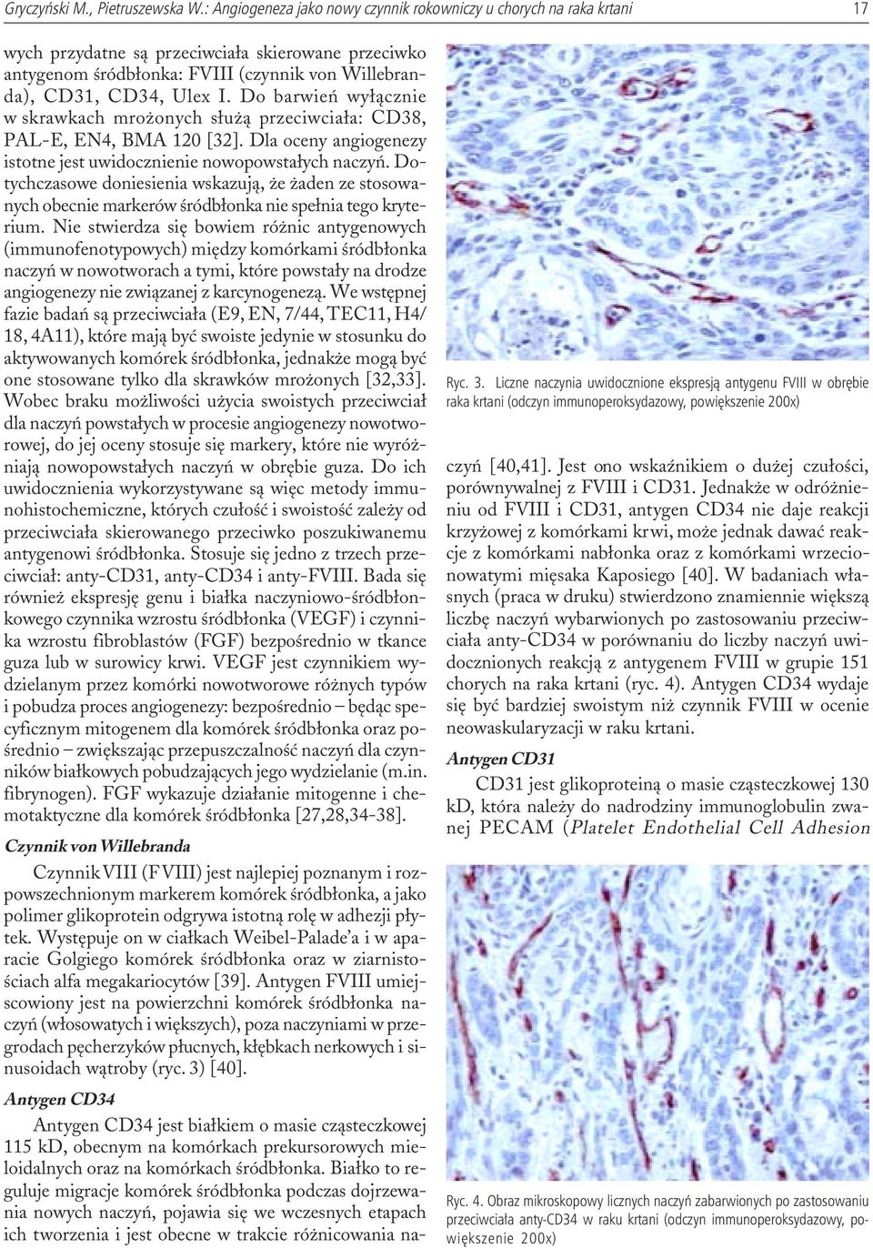Do barwieñ wy³¹cznie w skrawkach mro onych s³u ¹ przeciwcia³a: CD38, PAL-E, EN4, BMA 120 [32]. Dla oceny angiogenezy istotne jest uwidocznienie nowopowsta³ych naczyñ.