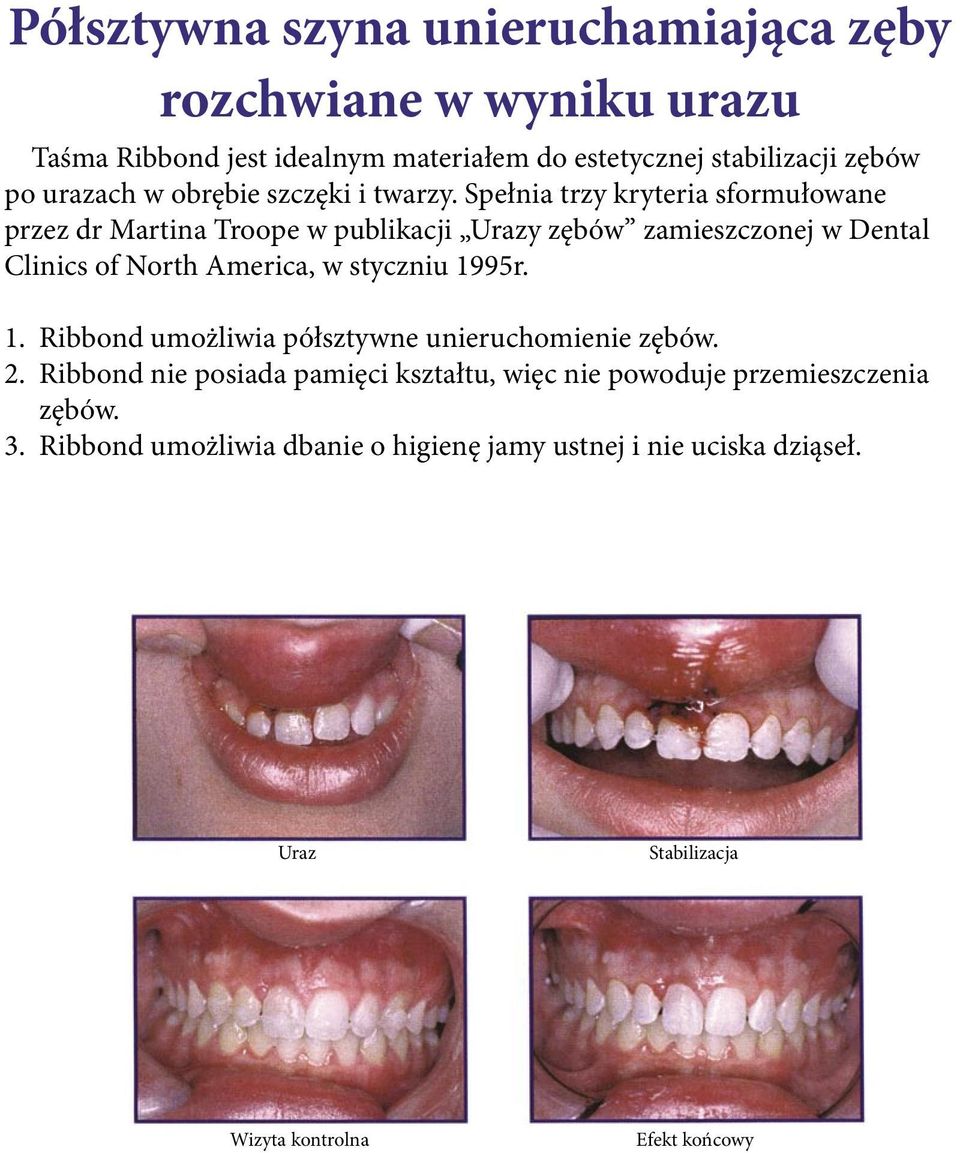 Spełnia trzy kryteria sformułowane przez dr Martina Troope w publikacji Urazy zębów zamieszczonej w Dental Clinics of North America, w styczniu