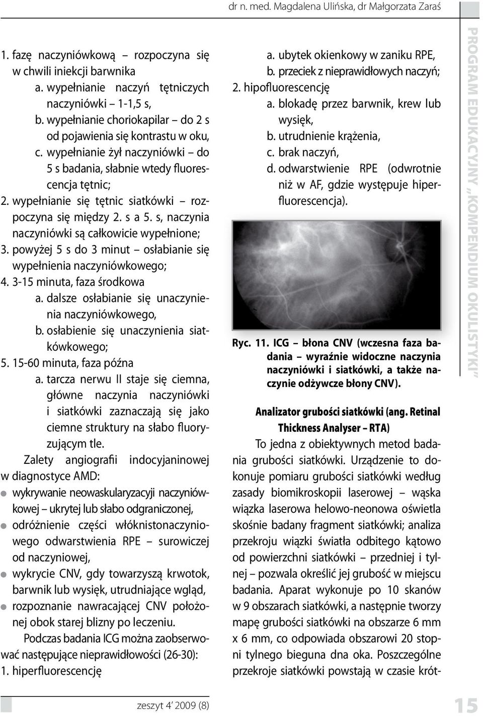 wypełnianie się tętnic siatkówki rozpoczyna się między 2. s a 5. s, naczynia naczyniówki są całkowicie wypełnione; 3. powyżej 5 s do 3 minut osłabianie się wypełnienia naczyniówkowego; 4.