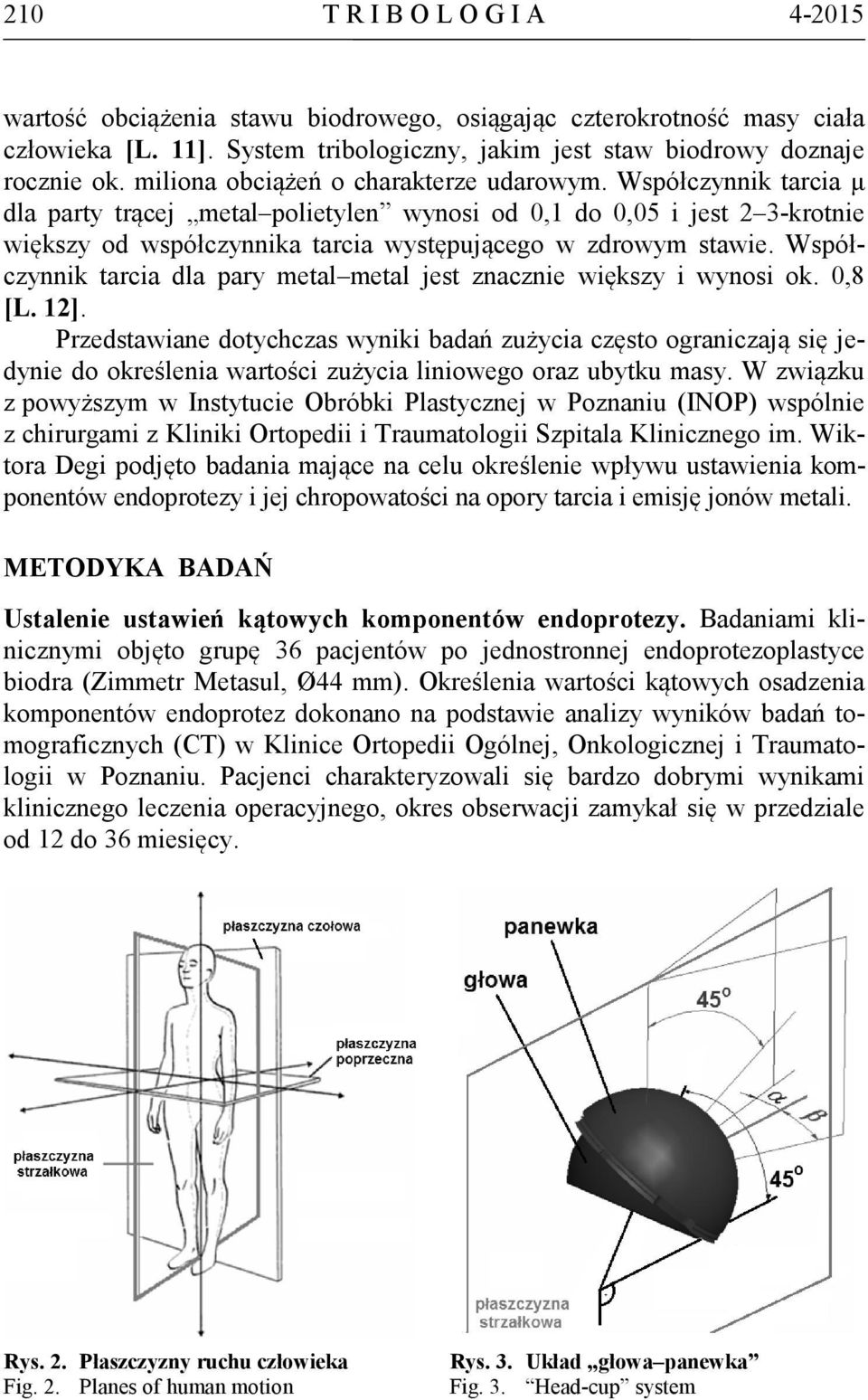 Współczynnik tarcia μ dla party trącej metal polietylen wynosi od 0,1 do 0,05 i jest 2 3-krotnie większy od współczynnika tarcia występującego w zdrowym stawie.