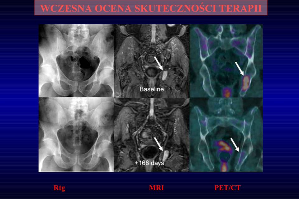 SKUTECZNOŚCI