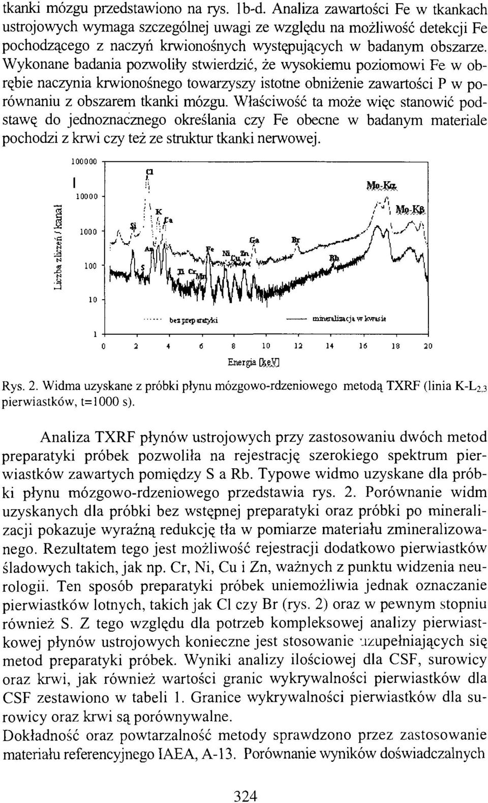 Wykonane badania pozwoliły stwierdzić, że wysokiemu poziomowi Fe w obrębie naczynia krwionośnego towarzyszy istotne obniżenie zawartości P w porównaniu z obszarem tkanki mózgu.