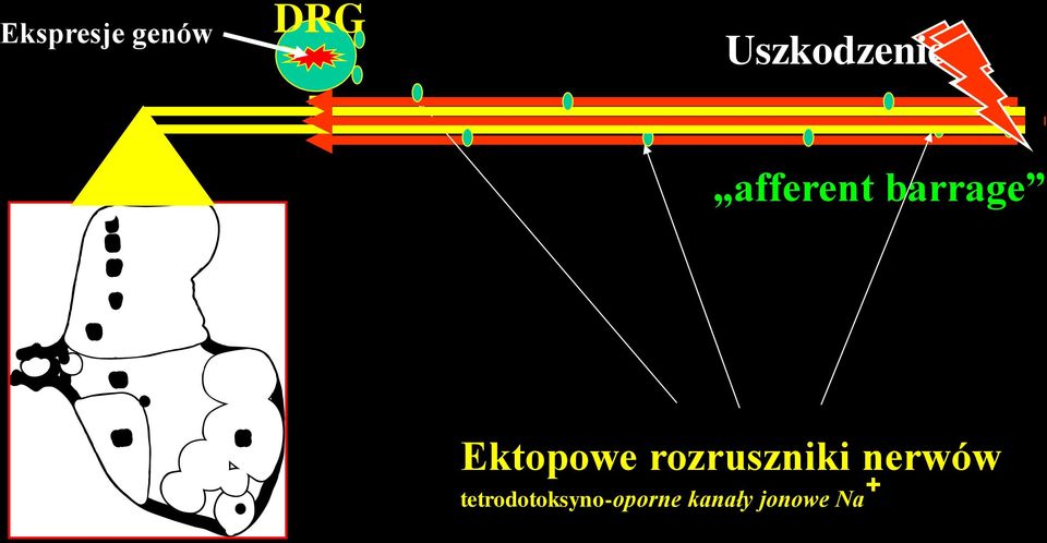 Ektopowe rozruszniki nerwów