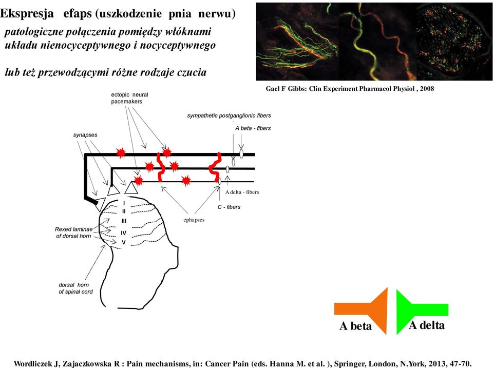 postganglionic fibers synapses A beta - fibers A delta - fibers Rexed laminae of dorsal horn I II III IV V ephapses C - fibers dorsal horn