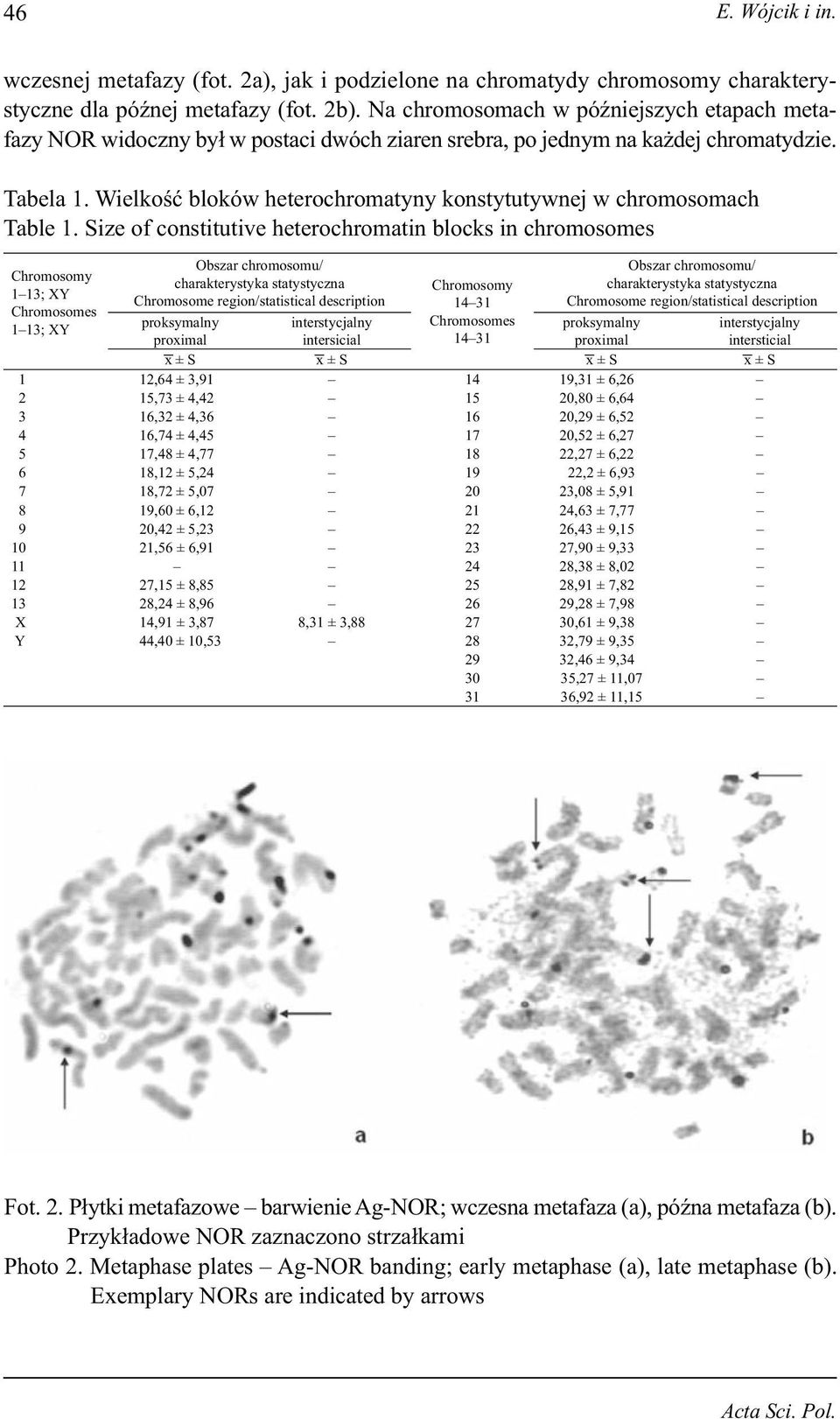 Wielkość bloków heterochromatyny konstytutywnej w chromosomach Table 1.