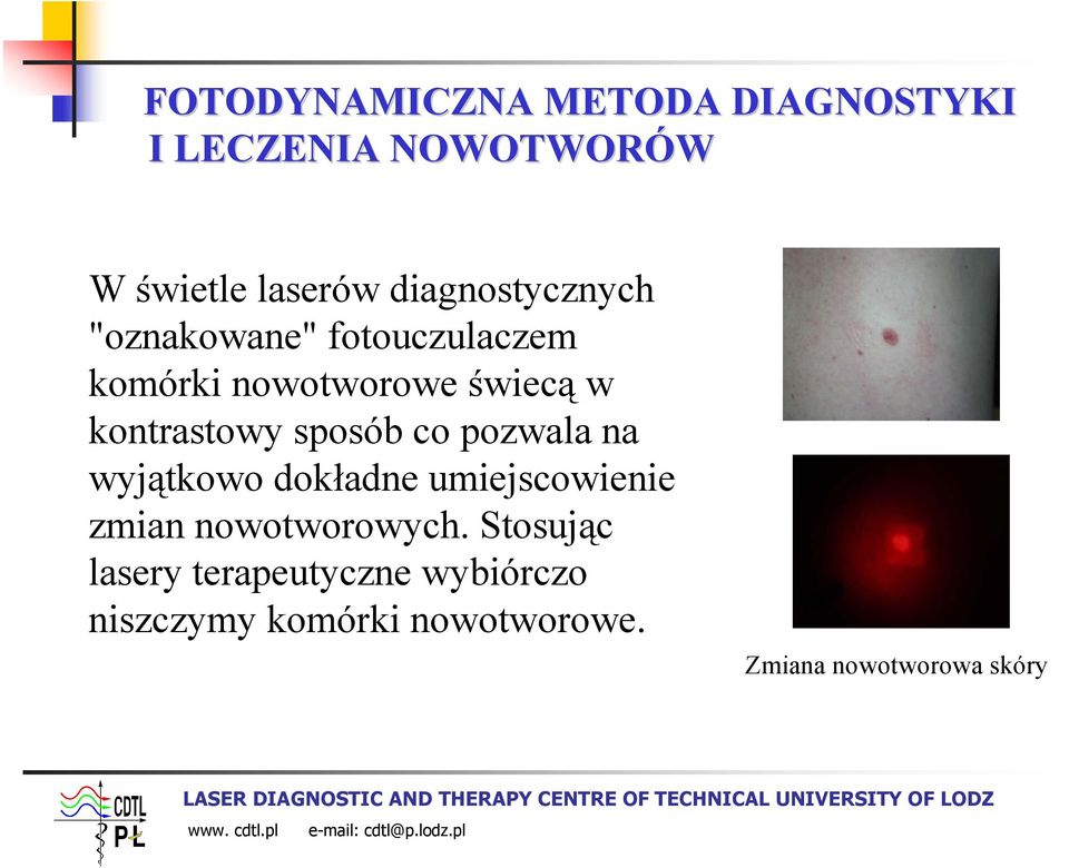 kontrastowy sposób co pozwala na wyjątkowo dokładne umiejscowienie zmian