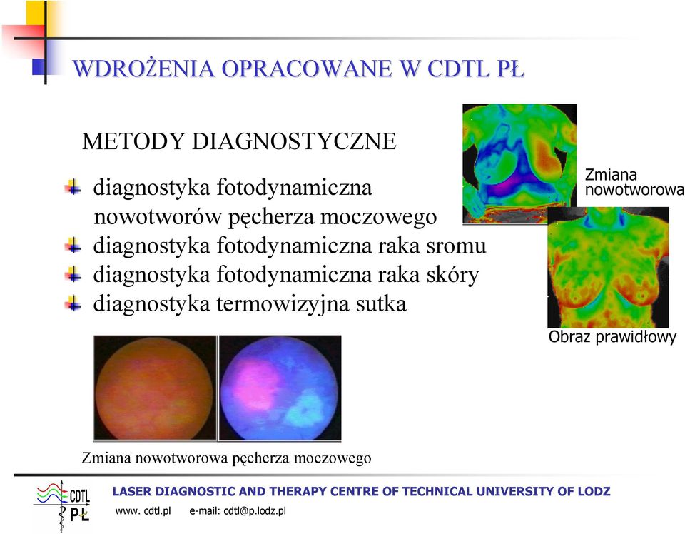 raka sromu diagnostyka fotodynamiczna raka skóry diagnostyka