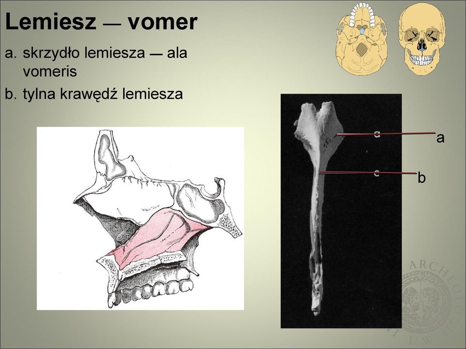 ala vomeris b.