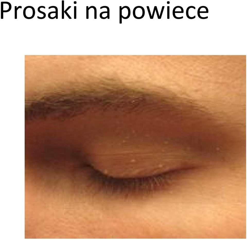 powiece