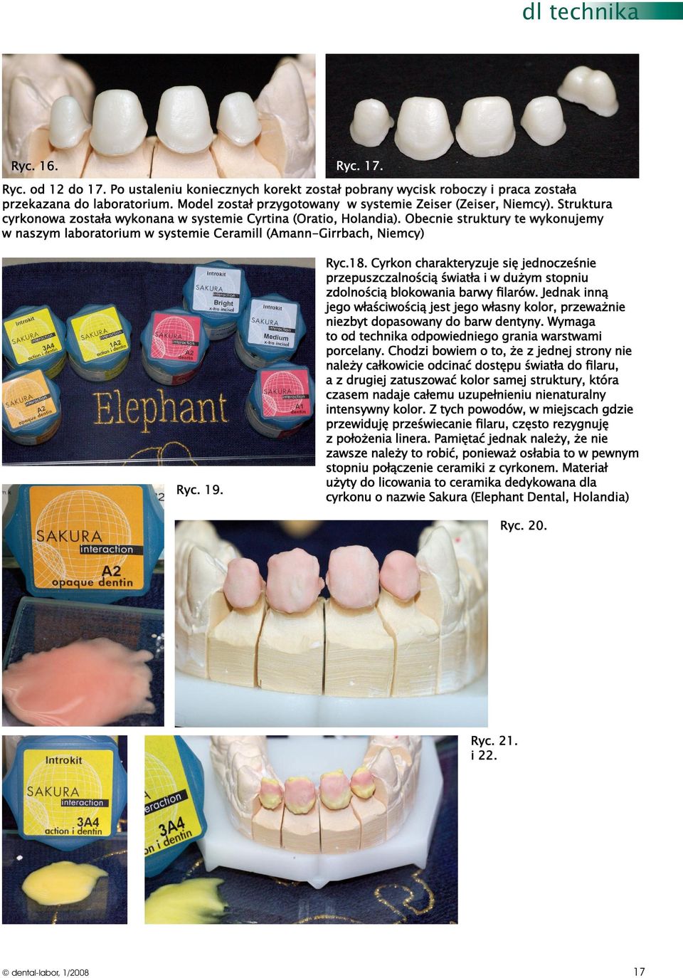 Obecnie struktury te wykonujemy w naszym laboratorium w systemie Ceramill (Amann-Girrbach, Niemcy) Ryc. 19. Ryc.18.