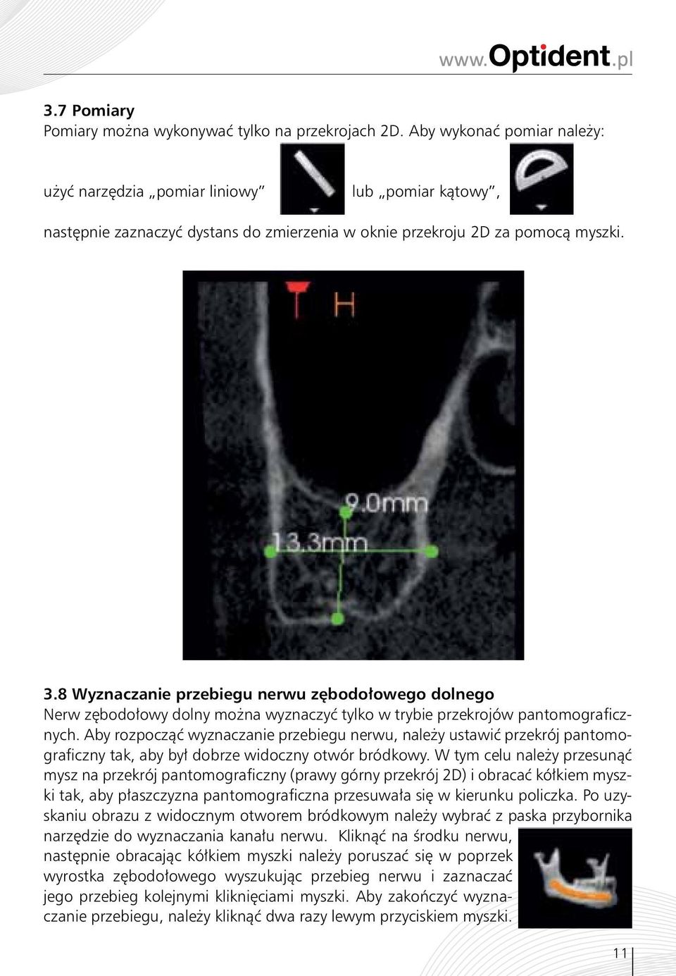 8 Wyznaczanie przebiegu nerwu zębodołowego dolnego Nerw zębodołowy dolny można wyznaczyć tylko w trybie przekrojów pantomograficznych.