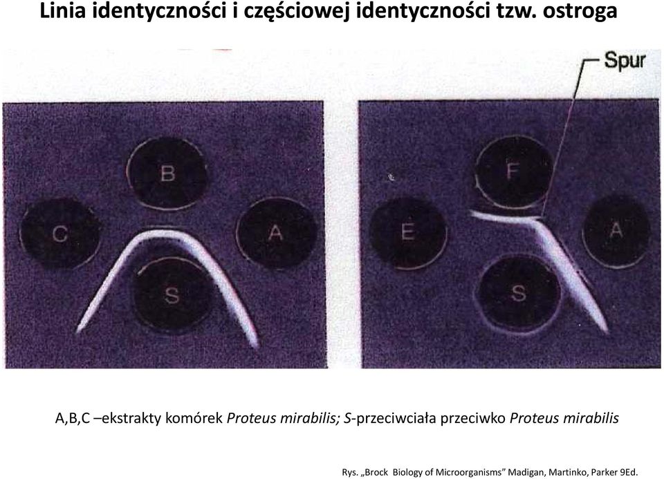 S przeciwciała przeciwko Proteus mirabilis Rys.