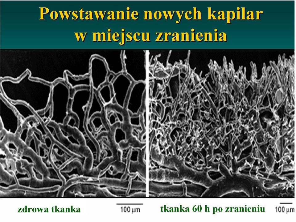 zranienia zdrowa