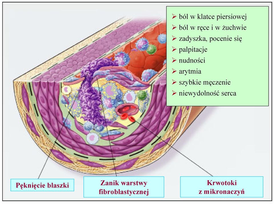 szybkie męczenie niewydolność serca Pęknięcie