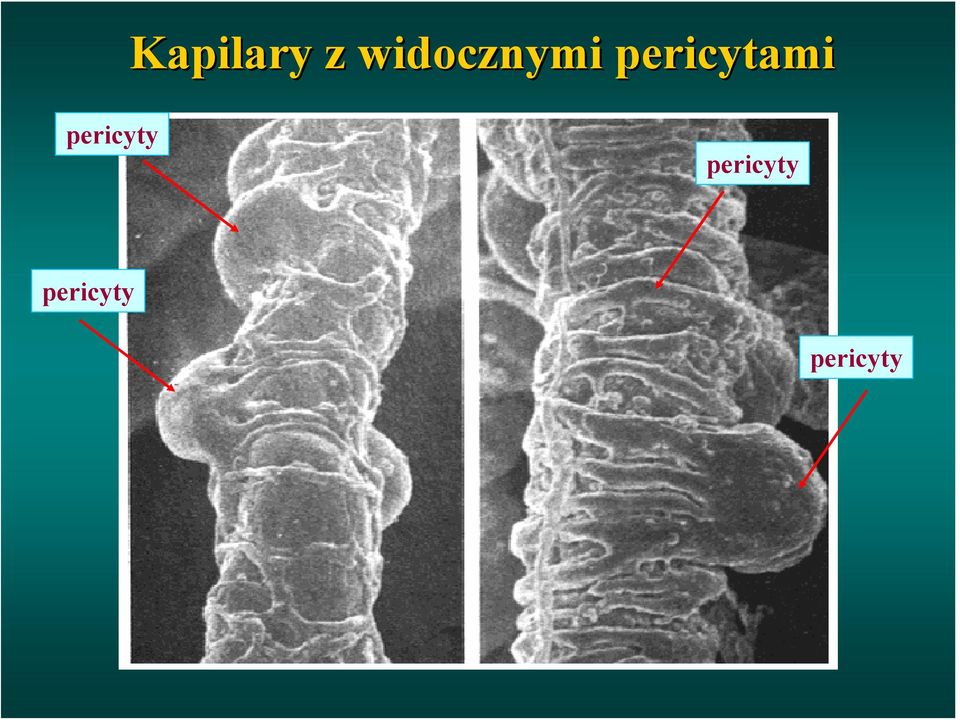 pericytami