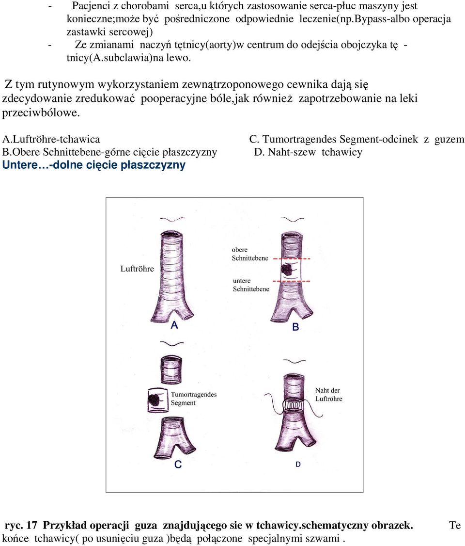 Z tym rutynowym wykorzystaniem zewnątrzoponowego cewnika dają się zdecydowanie zredukować pooperacyjne bóle,jak równieŝ zapotrzebowanie na leki przeciwbólowe. A.Luftröhre-tchawica B.