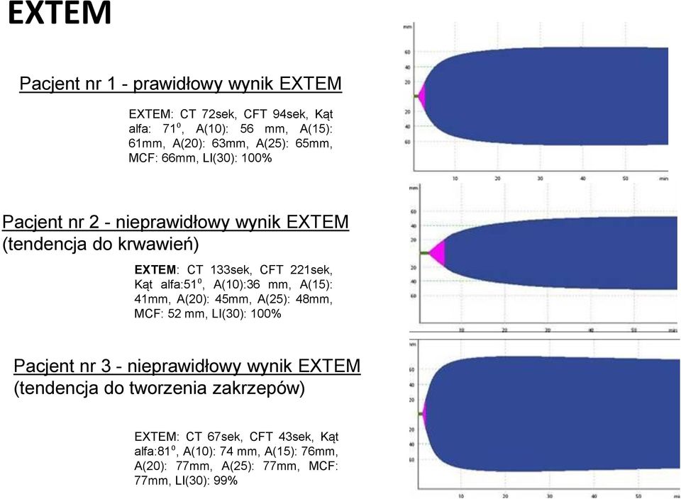 alfa:51⁰, A(10):36 mm, A(15): 41mm, A(20): 45mm, A(25): 48mm, MCF: 52 mm, LI(30): 100% Pacjent nr 3 - nieprawidłowy wynik EXTEM