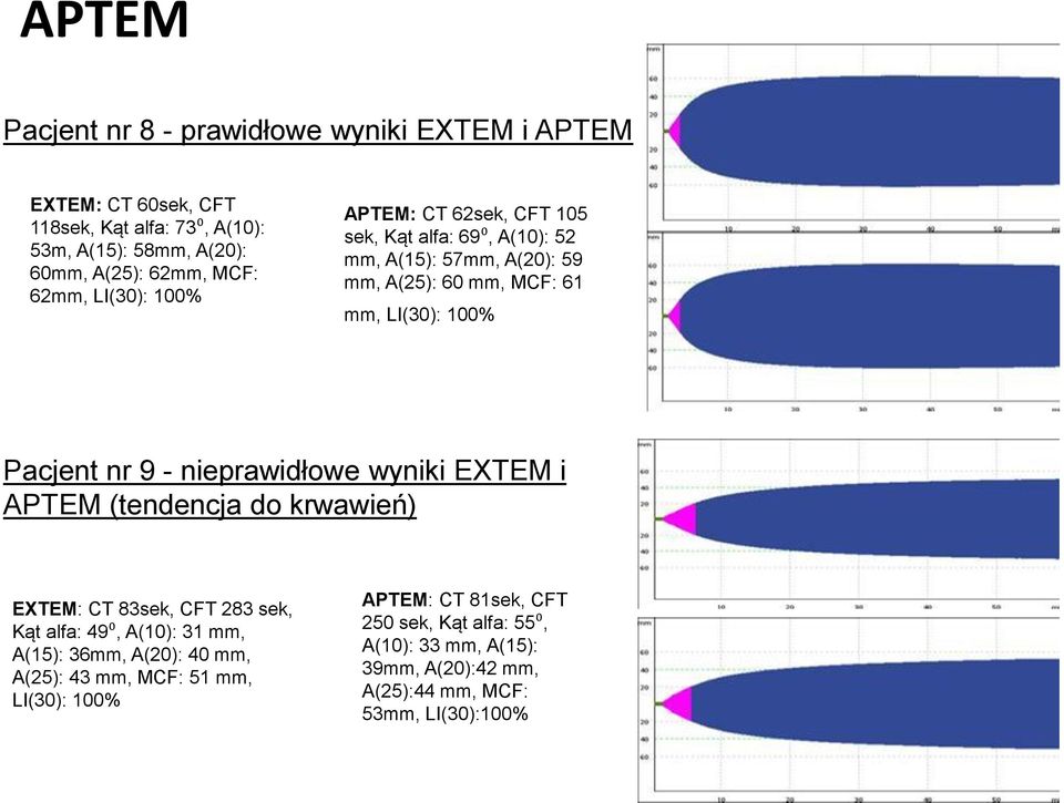 nr 9 - nieprawidłowe wyniki EXTEM i APTEM (tendencja do krwawień) EXTEM: CT 83sek, CFT 283 sek, Kąt alfa: 49⁰, A(10): 31 mm, A(15): 36mm, A(20): 40 mm,