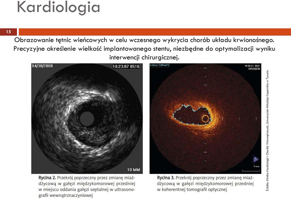 wczesnego wykrycia chorób układu krwionośnego.