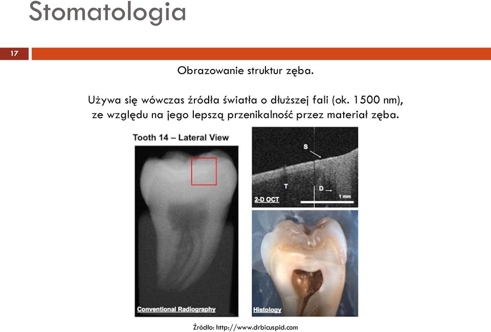 (ok. 1500 nm), ze względu na jego lepszą