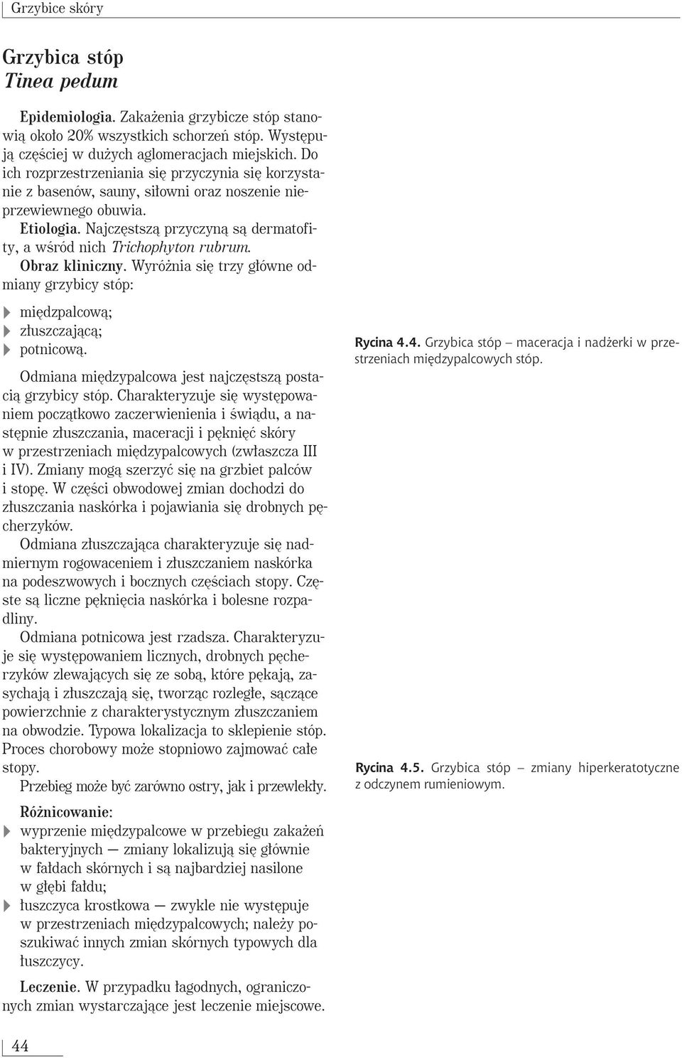 Najcz stszà przyczynà sà dermatofity, a wêród nich Trichophyton rubrum. Obraz kliniczny. Wyró nia si trzy g ówne odmiany grzybicy stóp: mi dzpalcowà; z uszczajàcà; potnicowà.