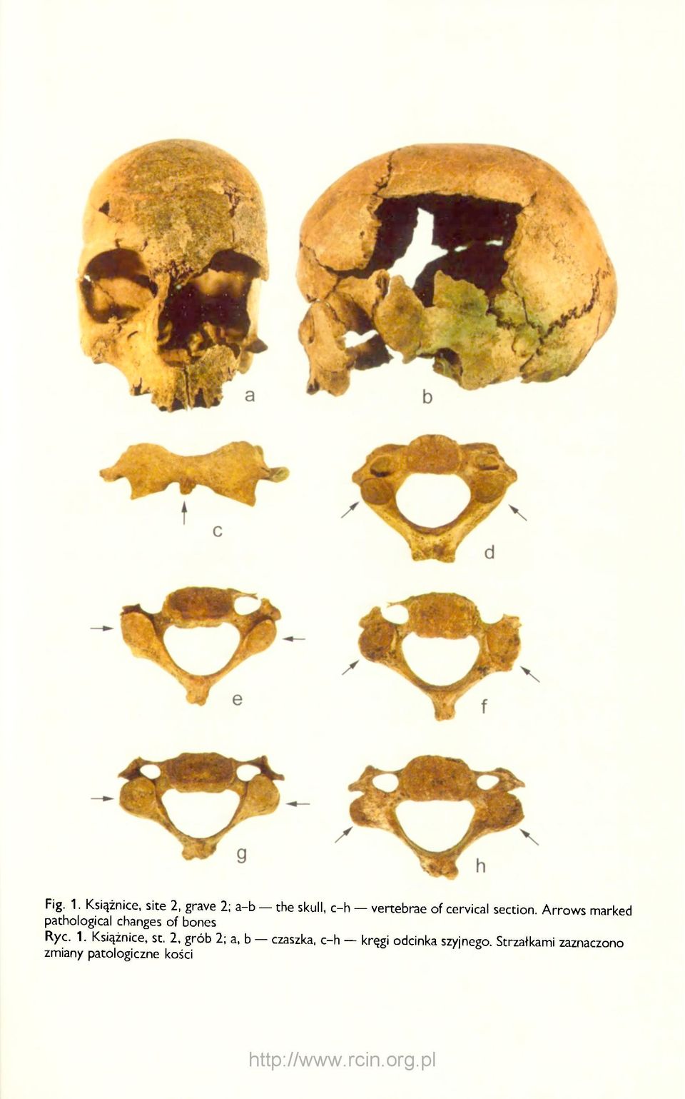 cervical section.