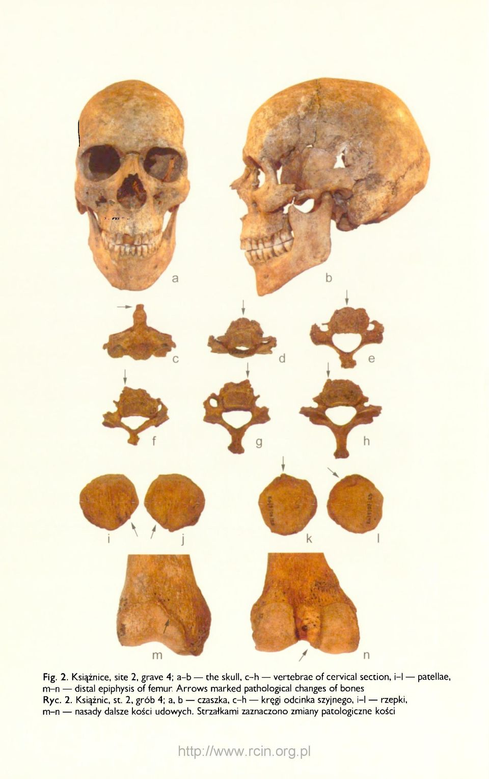 patellae, m-n distal epiphysis of femur.