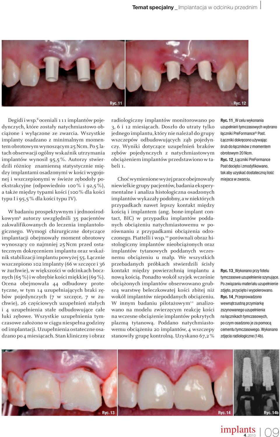 Autorzy stwierdzili różnicę znamienną statystycznie między implantami osadzonymi w kości wygojonej i wszczepionymi w świeże zębodoły poekstrakcyjne (odpowiednio 100% i 92,5%), a także między typami