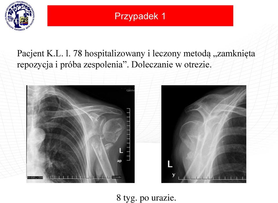 zamknięta repozycja i próba