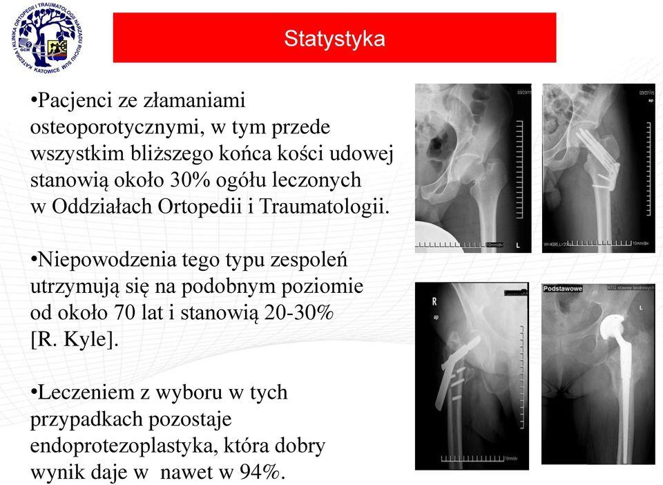 Niepowodzenia tego typu zespoleń utrzymują się na podobnym poziomie od około 70 lat i stanowią